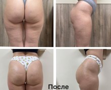 Современный массажный сервис в Чигирях