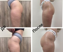 Современный массажный сервис в Чигирях