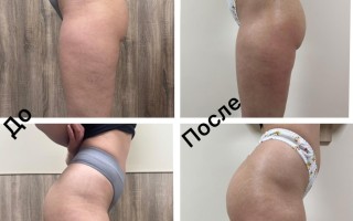 Массажный кабинет Елены