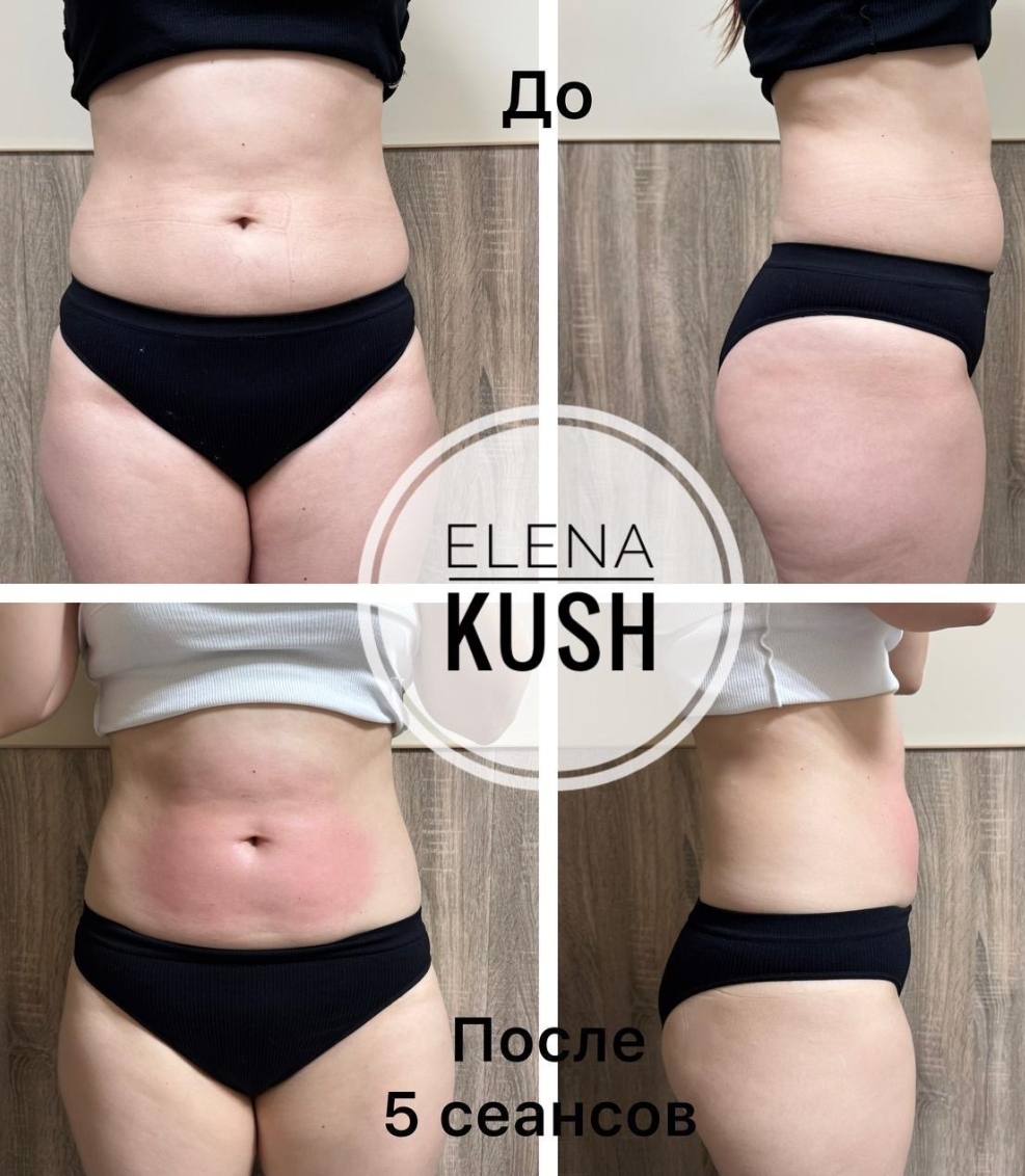 Ручной массаж и аппаратный уход за телом и лицом