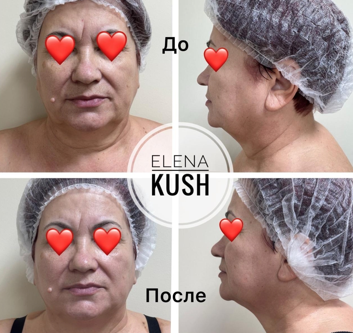 Ручной массаж и аппаратный уход за телом и лицом