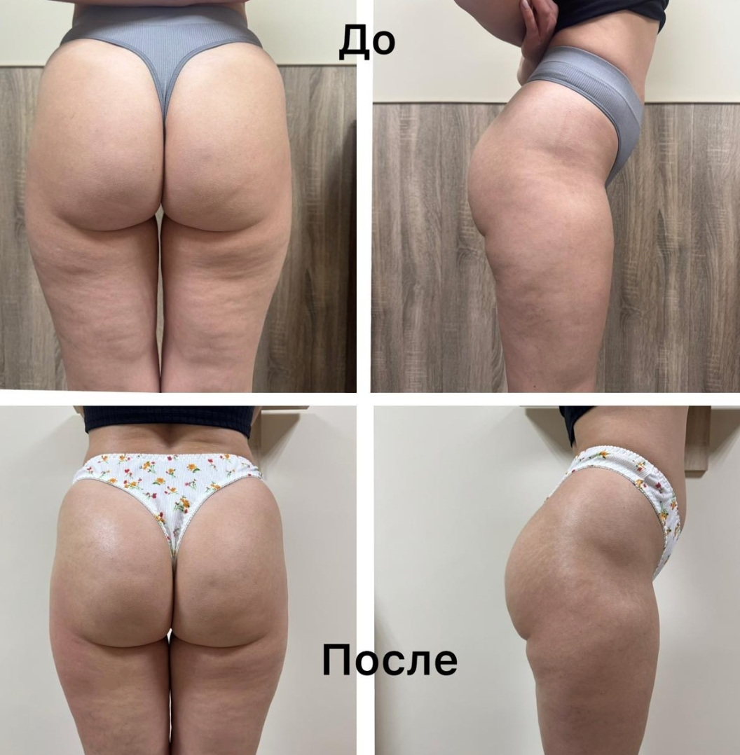 Ручной массаж и аппаратный уход за телом и лицом